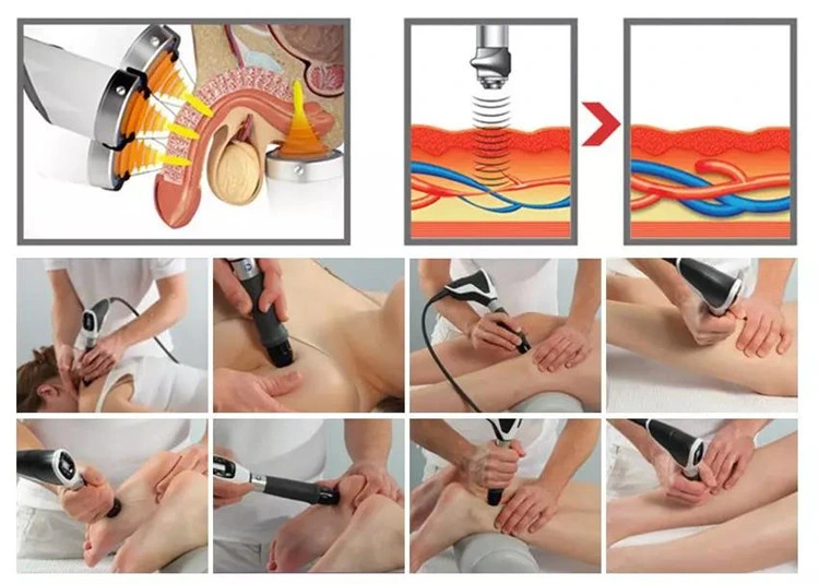 Multi-Purpose Professional Rehab Clinic Use Extracorporeal Shockwave Therapeutic Device